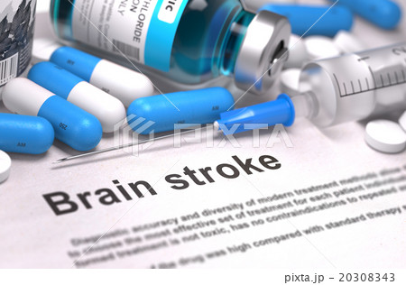 Brain Stroke Diagnosis. Medical Concept 20308343