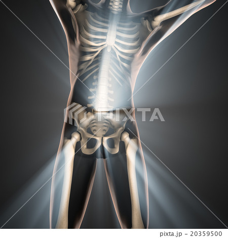 human bones radiography scan image 20359500