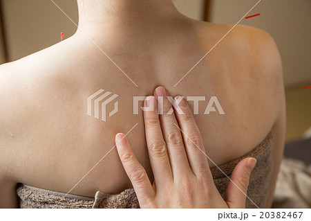 鍼灸 20382467