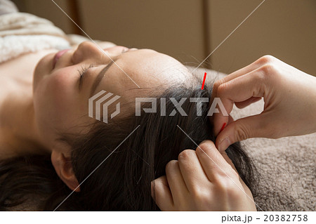 鍼灸 20382758