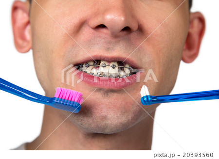 Man cleaning brackets, hygiene の写真素材 [20393560] - PIXTA