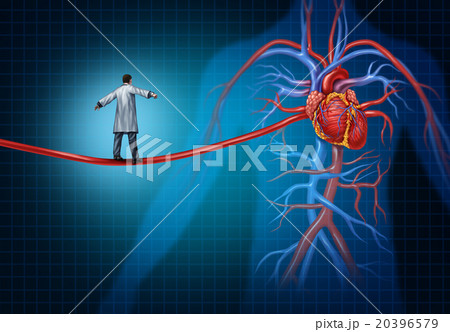 Heart Surgery Concept 20396579