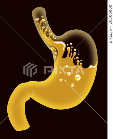 胃酸過多 20500000