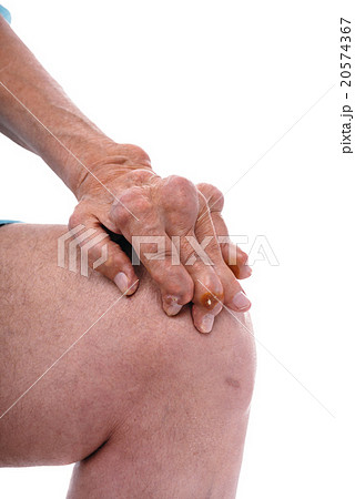 Man with a diagnosis of polyarthritis . 20574367