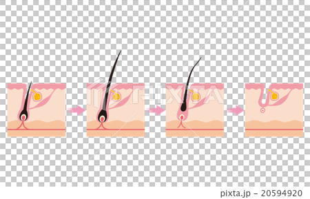 毛　毛周期　ヘアサイクル 20594920