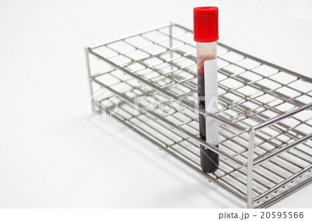 Blood sample in a test tube Vacutainer Blood sample in a test tube Vacutainer 20595566