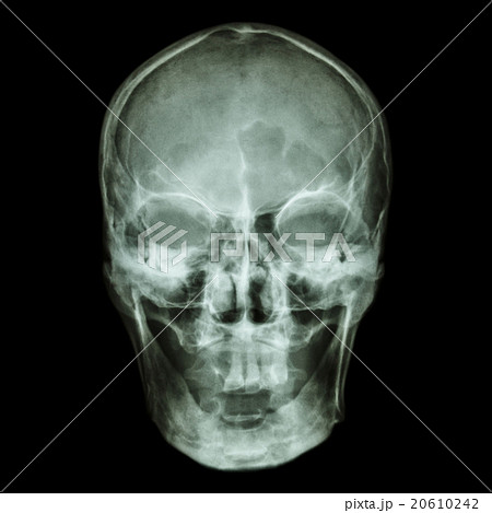 X-ray skull (Asian) X-ray skull (Asian) 20610242