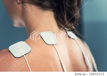 TENS electrodes 20632312