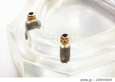 インプラント インプラント 20644664