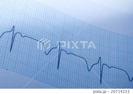 医療イメージ/心電図 20714253