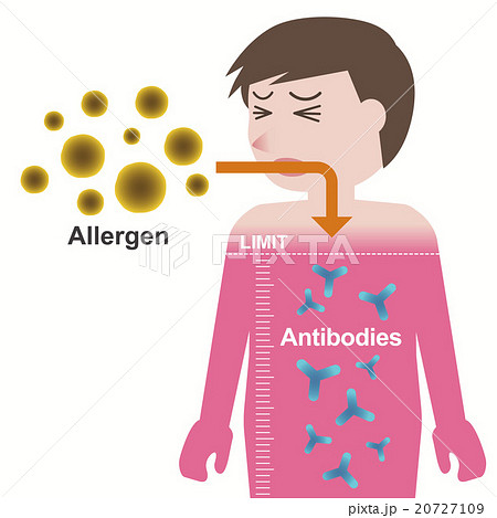 アレルギー発症のしくみ アレルギー発症のしくみ 20727109