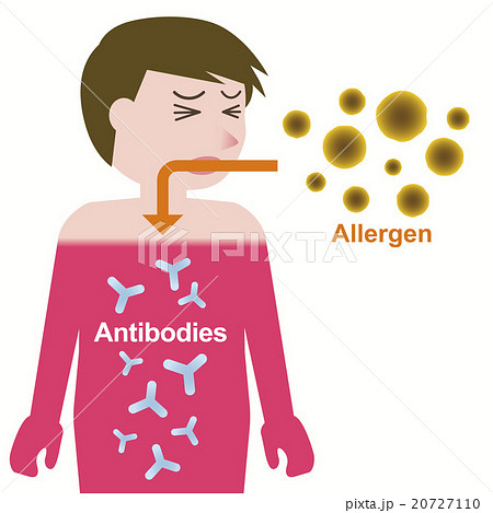 アレルギー発症のしくみ アレルギー発症のしくみ 20727110