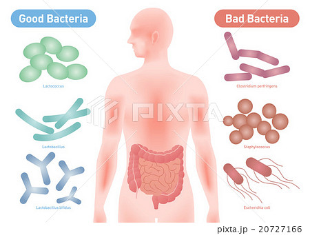 善玉菌と悪玉菌 腸内細菌イメージ 善玉菌と悪玉菌 腸内細菌イメージ 20727166