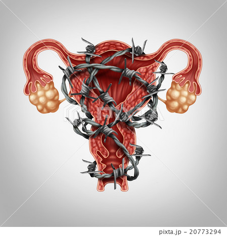 Uterus Pain Uterus Pain 20773294