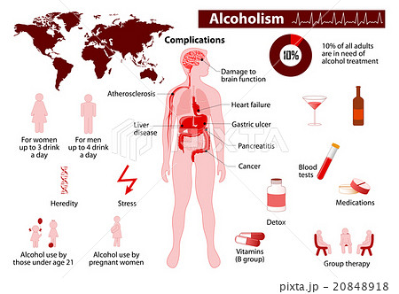 Alcoholism infographic 20848918