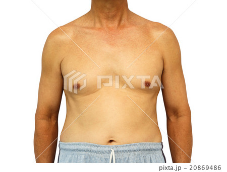 Body of old patient on isolated background Body of old patient on isolated background 20869486