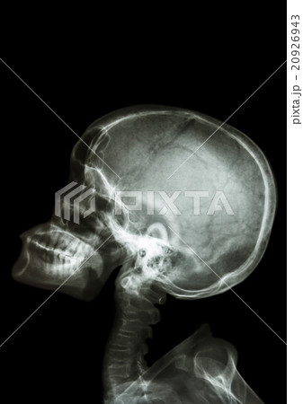 X-ray asian kid look up X-ray asian kid look up 20926943