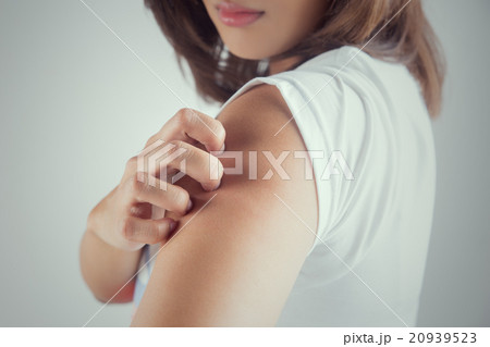 Woman scratching her arm. Woman scratching her arm. 20939523