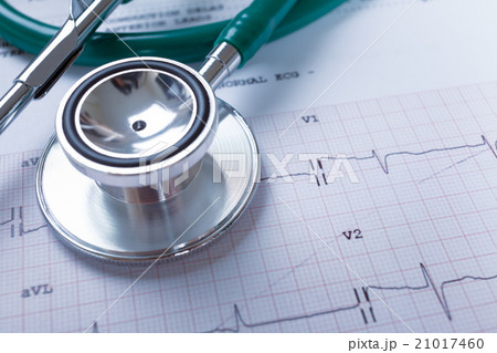 Stethoscope on an electrocardiogram (ECG) chart  21017460