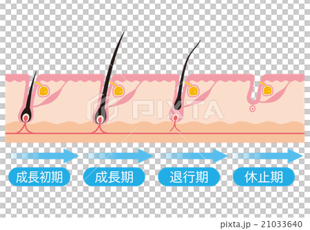脱毛　毛周期　ヘアサイクル 21033640
