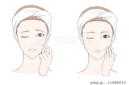 スキンケア イラスト にきびのイラスト素材