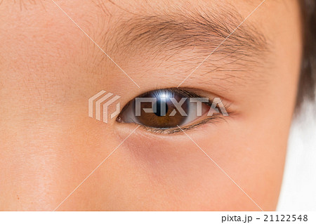 アジア人のつぶらな子供の片目　 Eyes of the child 21122548