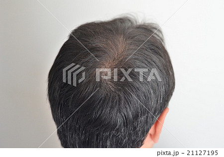 40代男性の薄い頭頂部の写真素材