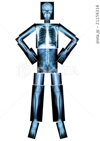 Human bone stand and akimbo  21156316