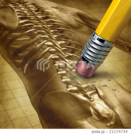 Back Pain Therapy 21174734
