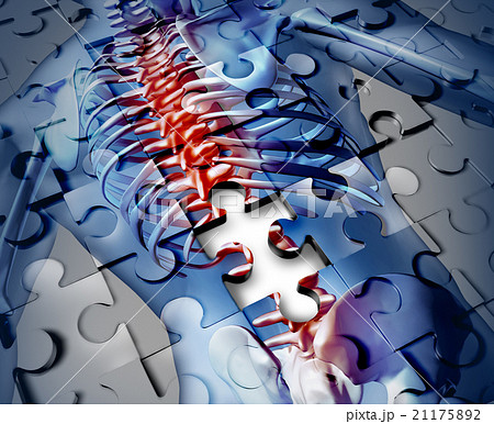 Human Back Disease 21175892