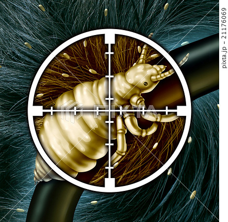 Kill Lice Kill Lice 21176069