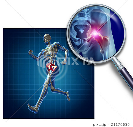 Sports Hip Injury 21176656