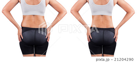 fat women from rear,before and after weight loss 21204290