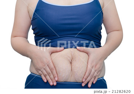 Asian woman in swim suit showing her stretch marks Asian woman in swim suit showing her stretch marks 21282620