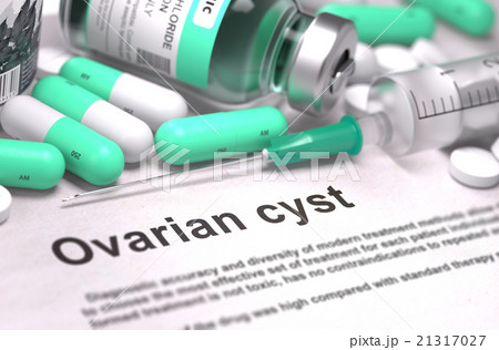 Ovarian Cyst Diagnosis. Medical Concept. Ovarian Cyst Diagnosis. Medical Concept. 21317027