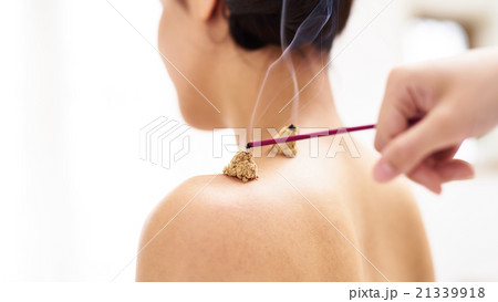 お灸をする女性 お灸をする女性 21339918