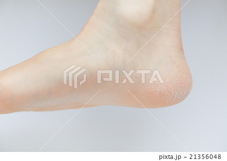 フットケア 21356048