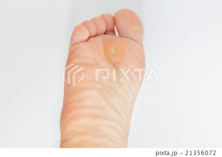 フットケア 21356072