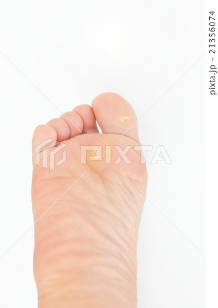 フットケア 21356074