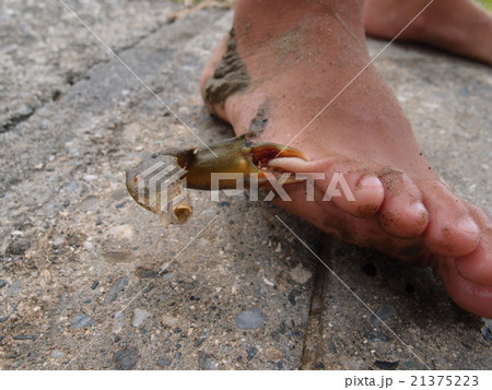 ガザミにはさまれた足 ガザミにはさまれた足 21375223