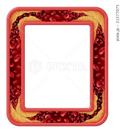 Artery Disease Frame 21377075