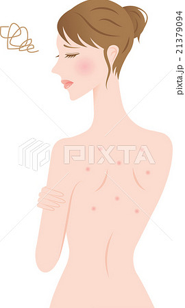 背中ニキビの女性 背中ニキビの女性 21379094