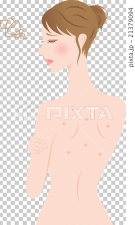 背中ニキビの女性 背中ニキビの女性 21379094