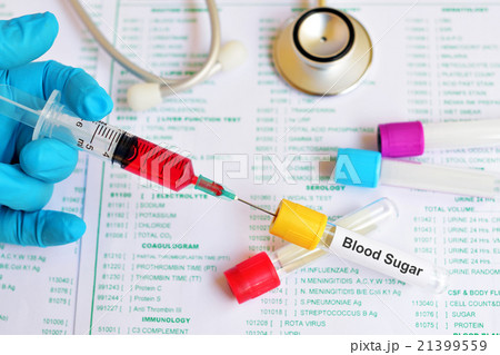 Blood sugar test 21399559