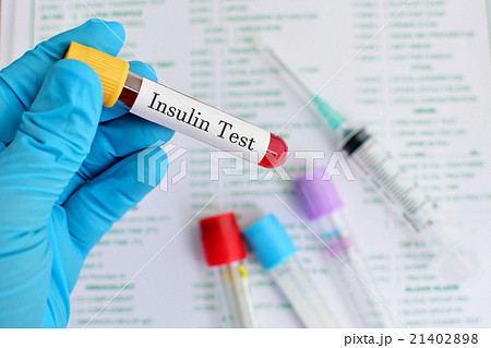 Insulin test 21402898