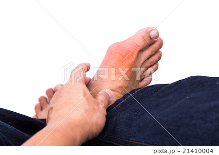 Man embraces foot with painful gout inflammation 21410004