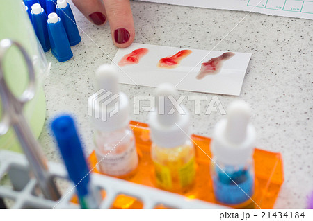 Blood type testing. Blood type testing. 21434184