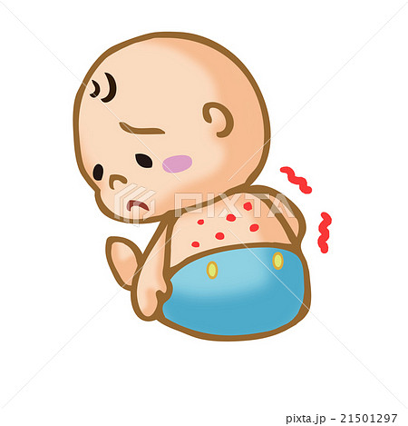 体に発疹のできた赤ちゃんのイラスト素材