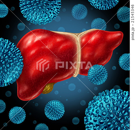 Hepatitis Liver Infection Hepatitis Liver Infection 21545346