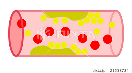 血管 血管 21558784